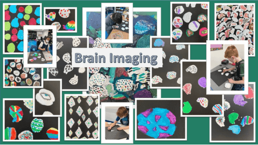 brain-image-collage-edited-compressed